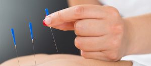 Acupuncturist Melbourne