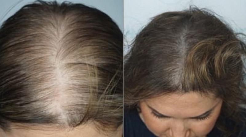 hair tattoo for women Gold Coast