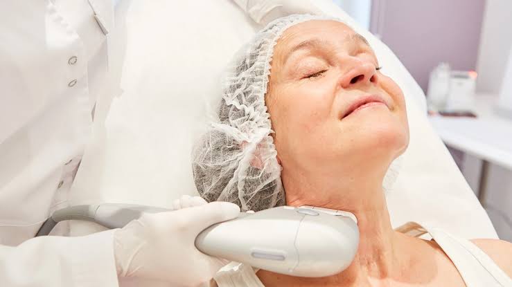 Skin tightening without surgery